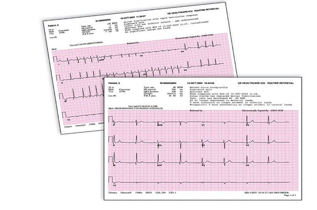 GE’s Marquette 12SL Algorithm Updates – Jaken Medical Inc.