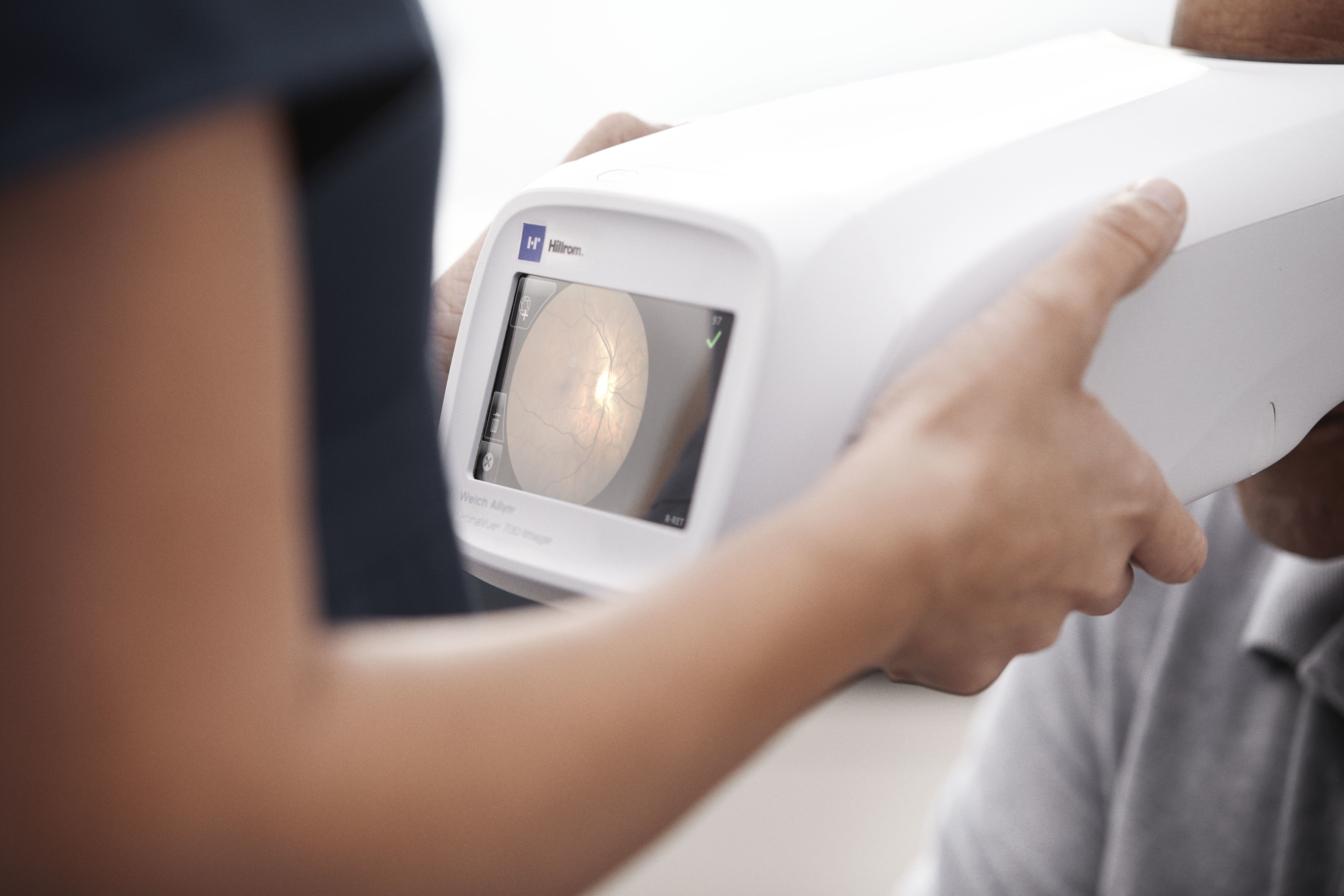 Retinavue Machine Welch Allyn RetinaVue 700 Imager – Jaken Medical Inc.