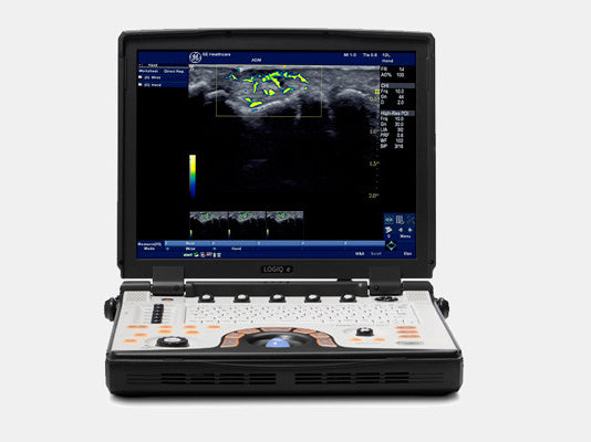 GE NextGen LOGIQ e R7 Ultrasound System | Jaken Medical – Jaken Medical ...