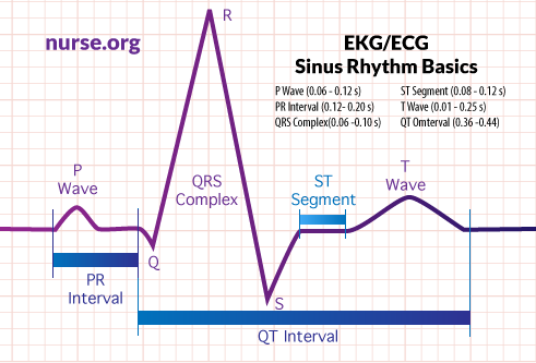 ECG/EKG Sinus Rhythm Basics